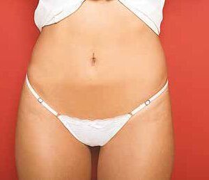 Cola less Regulable lisa de Algodón y Lycra c/ puntilla Pack x3